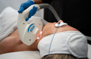 IPL-for-Pigmentation-What-It-Treats,-How-It-Works,-and-What-to-Expect