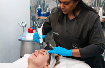dermapen-microneedling-timing-techniques-winter-success dermapen-microneedling-timing-techniques-winter-success