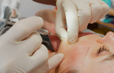 dermal-fillers-how-dermal-fillers-restore-facial-structure
