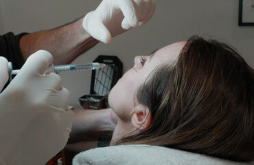 dermal-fillers-hyaluronic-acid-eye-rejuvenation-tear-trough