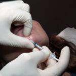 botulinum-toxin-beyond-frown-lines-lift-balance-lower-face