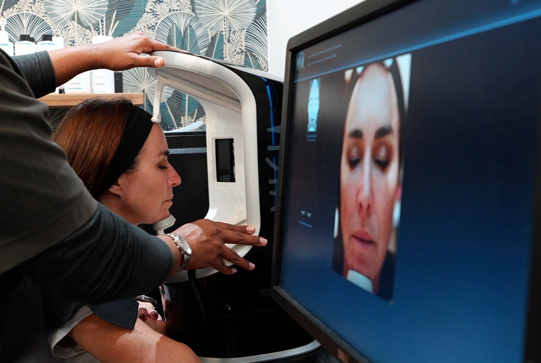 hyperpigmentation-melasma-stubborn-pigmentation-treatment-protocol